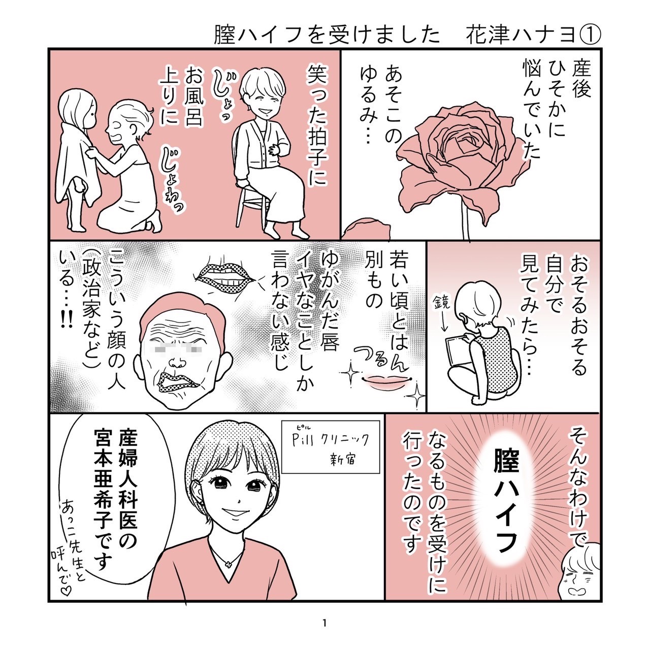 Pill クリニック　膣ハイフ体験漫画