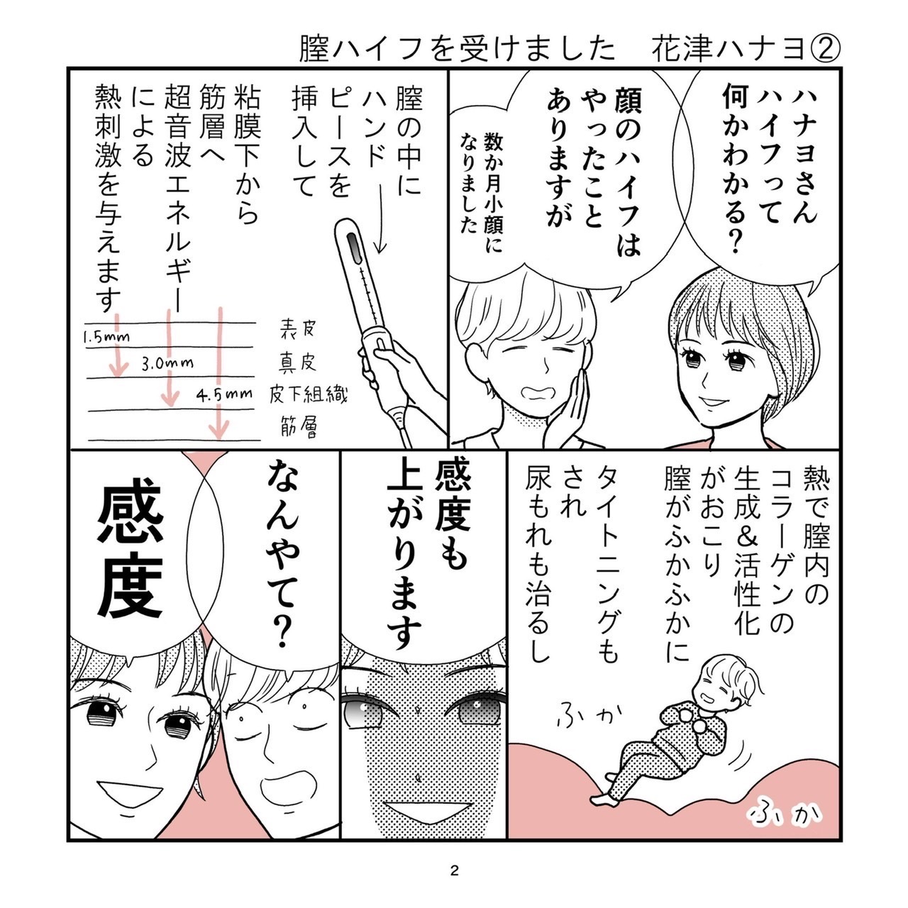 Pill クリニック　膣ハイフ体験漫画