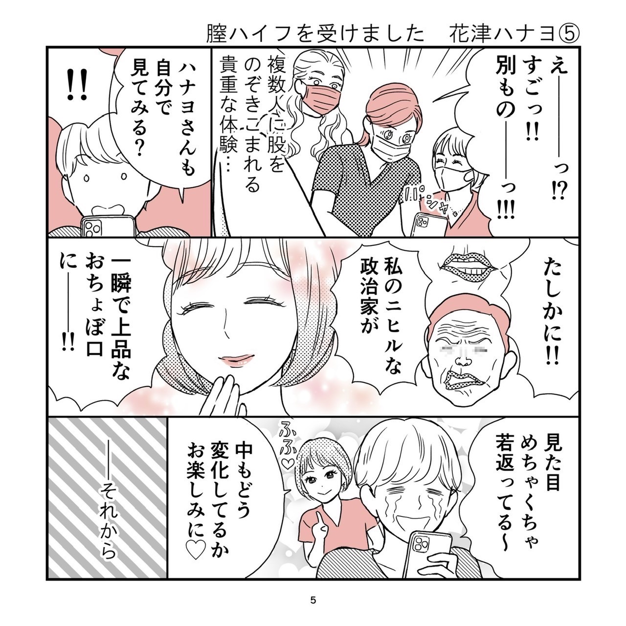 Pill クリニック　膣ハイフ体験漫画